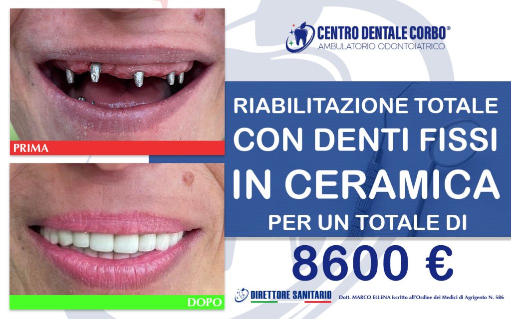prima e dopo Gennaio 1