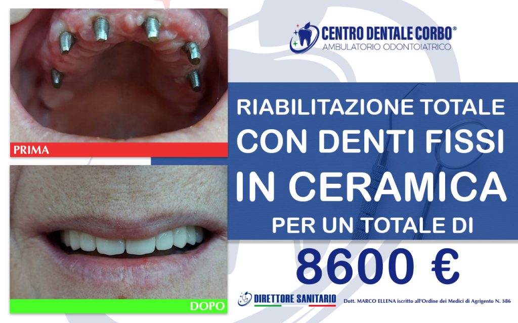 prima e dopo Gennaio 2