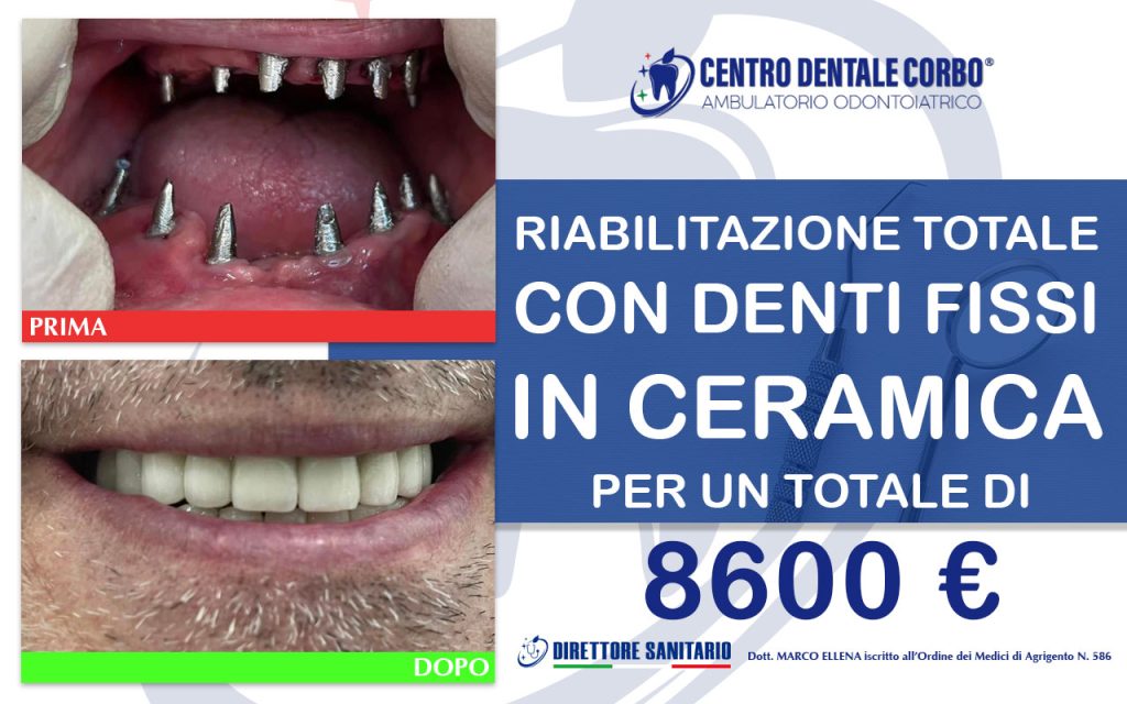 prima e dopo Gennaio 3