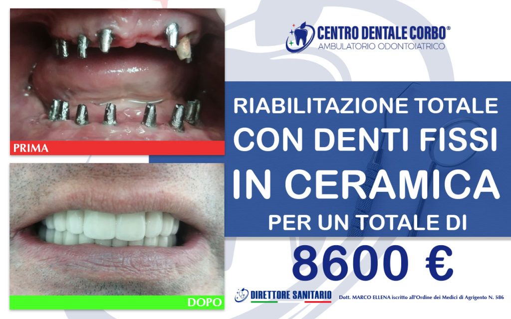 prima e dopo Gennaio 4