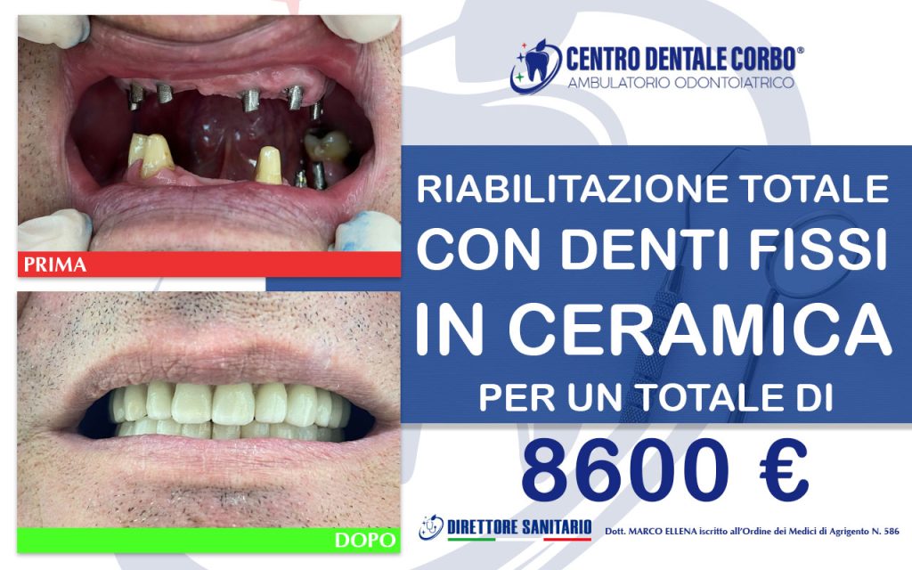 prima e dopo Gennaio 5