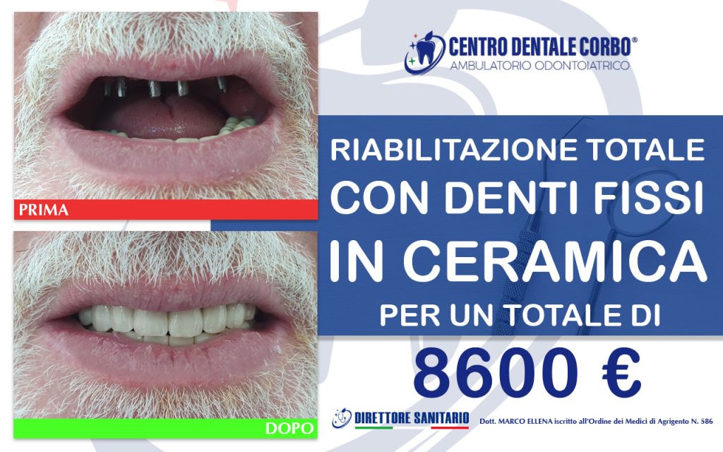 prima e dopo Gennaio 6