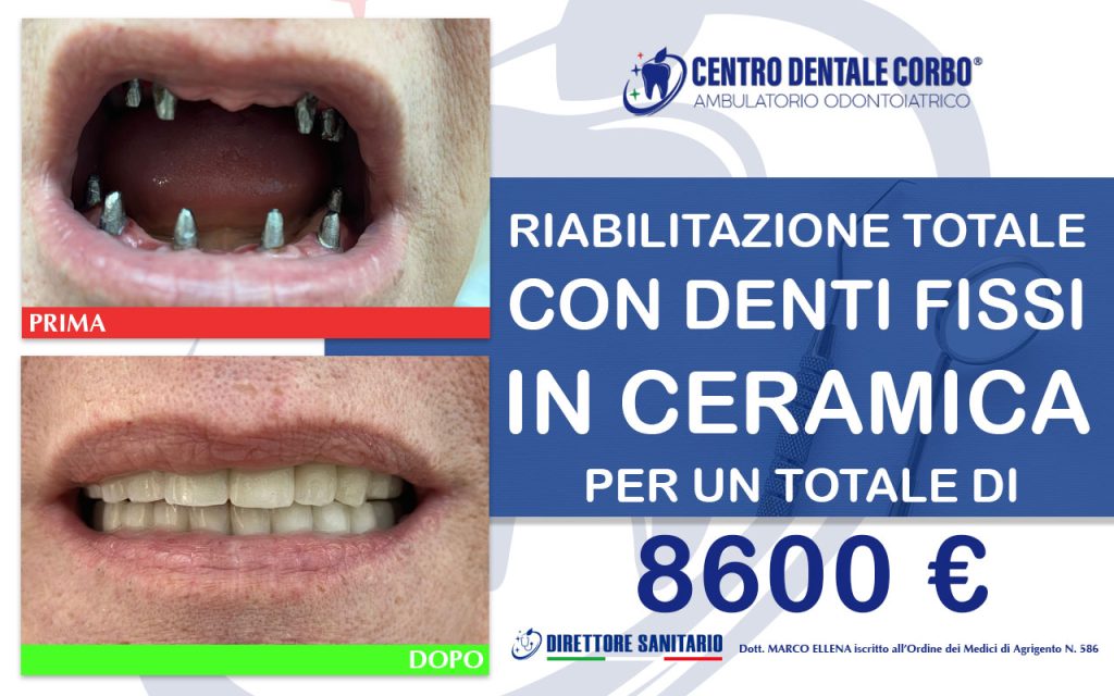 prima e dopo Febbraio 2